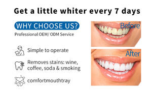 Novo Equipamento Odontológico Kit de Clareamento <span class=keywords><strong>Dental</strong></span> UV com LOGO Privado para Clínicas Profissionais, Kit de Clareamento para Dentes Sensíveis - Product Image 5