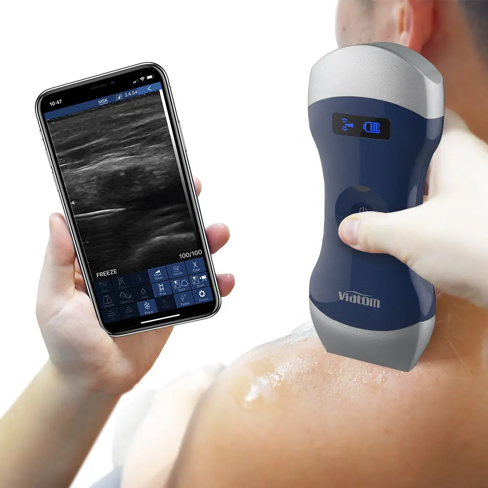 Viatom Dual-head Healthcare Pocket Ultrasound Applicable In Hospital/emergency/outdoor Wireless Handheld Ultrasound Scanner