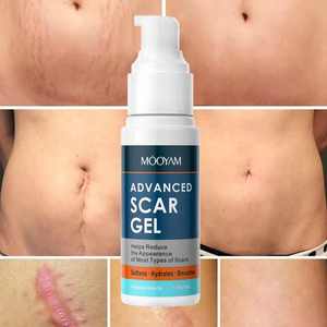 Mooyam Keloid Removal Fastest Scar Gel Private Label <strong>Bruises</strong> Repair Reduce <strong>Bruises</strong> Repair Tummy Tuck <strong>Cream</strong> 50ml Removal Scar Gel - Product Image 1