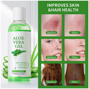 OEM/ODM Produits de soins de la peau en vrac de <span class=keywords><strong>gel</strong></span> d'<span class=keywords><strong>aloe</strong></span> <span class=keywords><strong>vera</strong></span> de Chine <span class=keywords><strong>Gel</strong></span> d'<span class=keywords><strong>aloe</strong></span> <span class=keywords><strong>vera</strong></span> hydratant <span class=keywords><strong>Gel</strong></span> d'<span class=keywords><strong>aloe</strong></span> <span class=keywords><strong>vera</strong></span> <span class=keywords><strong>bio</strong></span> de marque privée - Product Image 3
