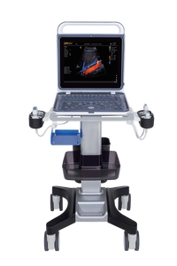 Máquina de Ultrassom Veterinário BMV BPU60C 3D/4D Doppler Colorido B/W USB Recarregável Certificado CE Classe II Garantia de 2 Anos Monitor - Product Image 3