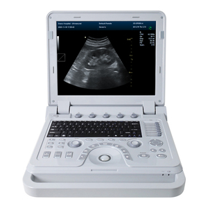 เครื่องอัลตราซาวนด์สัตว์แบบพกพา CONTEC CMS600P2PLUS-VET - Product Image 1