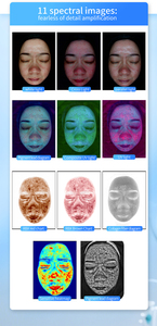 Intelligent 3D AI Facial Skin Analyzer Magic Mirror High-Definition Scalp Analysis and Traditional Chinese Medicine Management - Product Image 6