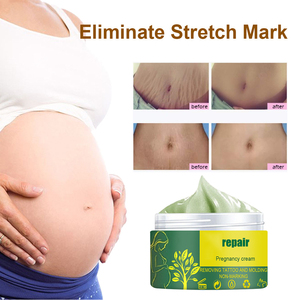 ครีมลบรอยแตกลายสำหรับการตั้งครรภ์ครีมลบรอยแผลเป็นผิวหย่อนคล้อยกระชับหน้าท้องไม่ระคายเคืองอ่อนโยนตามธรรมชาติ - Product Image 5