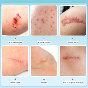 Parches Adhesivos Estériles, Impermeables y Altamente Absorbentes para Úlceras por Presión, Rollo de Hidrocoloide para el Cuidado de Quemaduras, Ampollas, Acné y Espinillas - Product Image 5