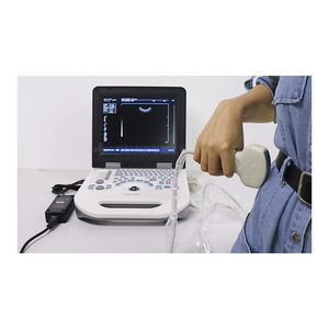 Diagnostic SY-AX50 12. Système d'ultrason vasculaire de pouce B & W avec la <span class=keywords><strong>sonde</strong></span> <span class=keywords><strong>vaginale</strong></span> - Product Image 4
