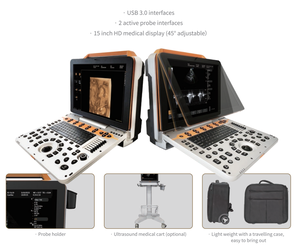 Ecógrafo Veterinario Portátil Dawei Ultrasound DW-P60, Doppler Color, Elastografía, Flujo Sanguíneo, Fabricado en Fábrica con Control Estricto de Calidad - Product Image 6
