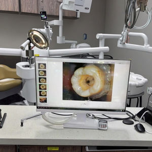 Endoscopio dentale elettrico All-in-One con chiara impugnatura dello schermo di Imaging in tempo reale per una diagnosi efficiente - Product Image 3