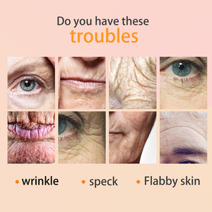 Siero Viso al Retinolo con Etichetta Privata OEM ODM, Marchio Personalizzato, Vitamina C, Vitamina E, Rassodante e Idratante per la Cura del Viso - Product Image 4
