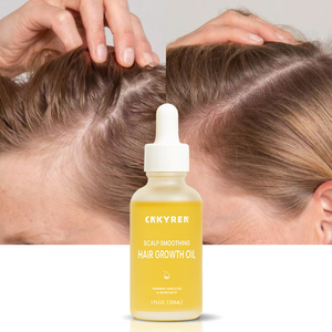 زيت أساسي لنمو الشعر، للعناية بفروة الرأس، مرطب، مقوي، يتحكم في التساقط، يغذي بصيلات الشعر للحصول على شعر كثيف - Product Image 1