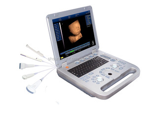 Cuaderno médico portátil con pantalla de 15 pulgadas, instrumento de ultrasonido 3D B/W para humanos con sonda OB/GYN/Vascular/Urología - Product Image 5
