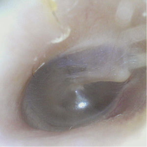 Penguin <span class=keywords><strong>Plus</strong></span> Otoscope de technologie MSI réutilisable de portée ORL sans fil haute définition pour une utilisation clinique pour les humains - Product Image 2