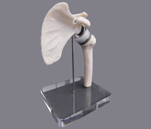 Modelo de Reemplazo de Articulación del Hombro - Modelo de Comunicación Médico-Paciente para Cirujanos Ortopédicos (Versión en Miniatura) - Product Image 4