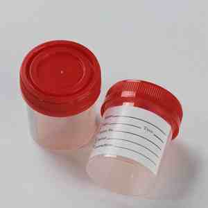 60Ml Laboratorium Medische Steriele Urinebeker Monster Pp Plastic Wegwerp Schroefdop Warmstempelvloeistof Specimen <span class=keywords><strong>Container</strong></span> - Product Image 2