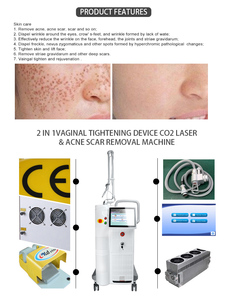 Láser fraccional de CO2 todo en uno de 60w para eliminación de pigmentos, lifting facial, máquina láser de CO2 con pantalla grande para uso en salones de belleza - Product Image 5