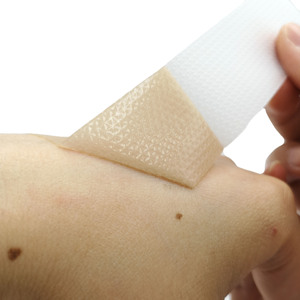 Feuilles de traitement des cicatrices en silicone de qualité professionnelle, prévient et traite les cicatrices anciennes et nouvelles, lot de 4 - Product Image 6