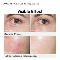 Nouvelle Ampoule Réparatrice Avancée N EXOSOME PDRN – Sérum Complexe Boostant les Cellules, Augmente la Densité Cutanée, Apaise les Rougeurs – Essence Coréenne pour Soins de la Peau