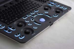 Sonosape E1 EXP Ultrasound <span class=keywords><strong>Doppler</strong></span> warna portabel, pemindai Ultrasound vaskuler portabel Laptop 15 inci LCD - Product Image 4