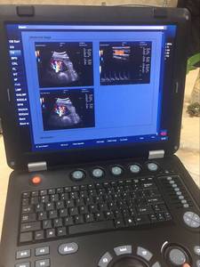 Échographe <span class=keywords><strong>portable</strong></span> couleur <span class=keywords><strong>Doppler</strong></span> pour diagnostic médical, appareil d'échographie <span class=keywords><strong>portable</strong></span> - Product Image 6