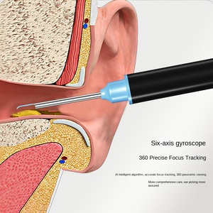Novo Otoscópio Visual Sem Fio Multifuncional Inteligente com Tecnologia de Clareamento HD e Cabeça Macia Integrada - Product Image 2