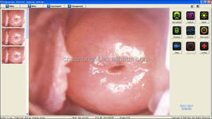 Sistema de imágenes de colposcopio digital de alta definición para examen vaginal - Product Image 6