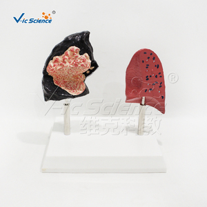 Modèle anatomique médical pour le tabagisme Modèle d'<span class=keywords><strong>anatomie</strong></span> humaine médicale Modèle de comparaison du <span class=keywords><strong>poumon</strong></span> fumeur de <span class=keywords><strong>poumon</strong></span> humain - Product Image 5