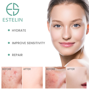 Estelin Bulk 30Ml Ceramide B5 Hydraterende Reparatie Gezicht Serum Custom Private Label Serum - Product Image 5