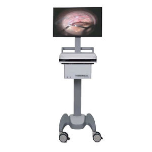 Microscope opératoire ophtalmologique InnoVue Opto SM-3000L, équipement médical pour la chirurgie oculaire en milieu hospitalier - Product Image 2