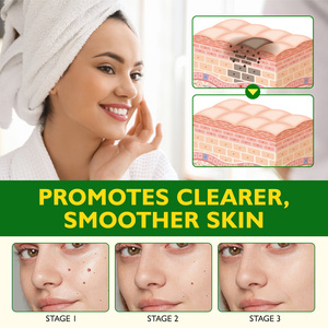 ELAIMEI <strong>Removes</strong> All Skin <strong>Warts</strong> Bee Venom <strong>Cream</strong> Skin Spot Smooths the Look of Fine Lines Skin Tag <strong>Removal</strong> Bee Venom <strong>Cream</strong> - Product Image 6