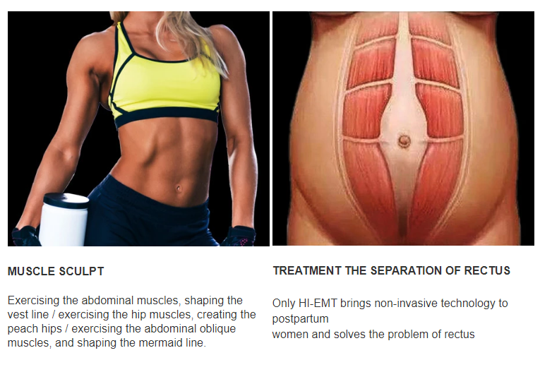 Emslim nova muscle training fat removal skin tightening with tesla hiemt ems rf heating energy 2 in 1