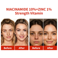 Sérum à la niacinamide 10% et au zinc 1% pour contrôler le sébum, minimiser les pores, éclaircir, apaiser les rougeurs, formule légère pour le visage, 30 ml