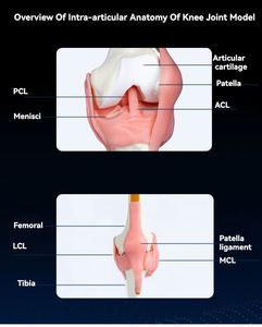 Modelo de Entrenamiento para Artroscopia de Rodilla KyrenMed con Abrazadera de Banco para Modelos Secos, Simulador de Entrenamiento para Cirugía de Artroscopia de Articulación de Rodilla - Product Image 3