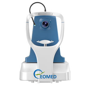 Système OCT Angio de Tomographie par Cohercence Optique Entièrement Intelligent avec Suivi Oculaire Automatique et <span class=keywords><strong>Angiographie</strong></span> (OCTA) OCTA80 - Product Image 3