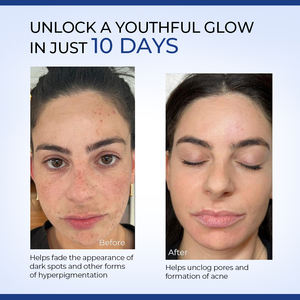 Limpiador Facial con Ácido Glicólico y Ácido Salicílico de Marca Blanca, Minimiza los Poros, Ilumina la Piel, para Adultos - Product Image 5