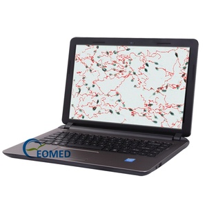 Analyse quantitative de la morphologie du sperme / Analyseur de la morphologie de la tête du sperme animal Équipement vétérinaire SA-6800P - Product Image 6