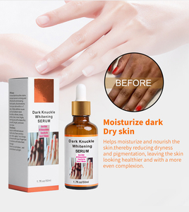 Suero Aclarante Rápido para Manos, Codos y Rodillas, Corrector de Pigmentación para Piel Oscura, Eliminador de Manchas Intensas - Product Image 4