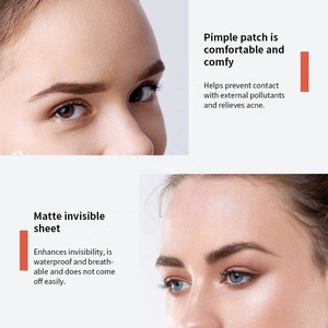 36 لاصقة جديدة لعلاج حب الشباب والبثور، رقعة هيدروكولويد مخصصة بشعار خاص، لاصقات علاجية للوجه من مورد متخصص - Product Image 5