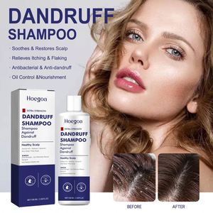 Shampooing personnalisé contre la dermatite séborrhéique shampooing antifongique pour le traitement <span class=keywords><strong>du</strong></span> <span class=keywords><strong>psoriasis</strong></span> et de la folliculite <span class=keywords><strong>du</strong></span> <span class=keywords><strong>cuir</strong></span> <span class=keywords><strong>chevelu</strong></span> - Product Image 2