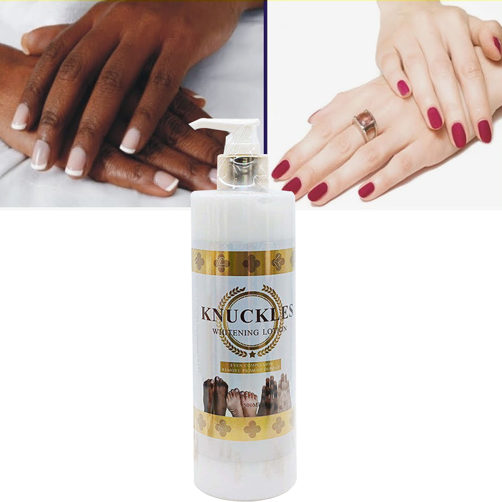 Best Permanent Skin Whitening Body Lotion for All Women
