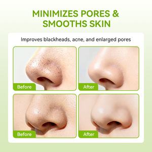 LANBENA Bandes nasales au charbon de bambou naturel pour un nettoyage en profondeur et l'élimination des points noirs - Product Image 3