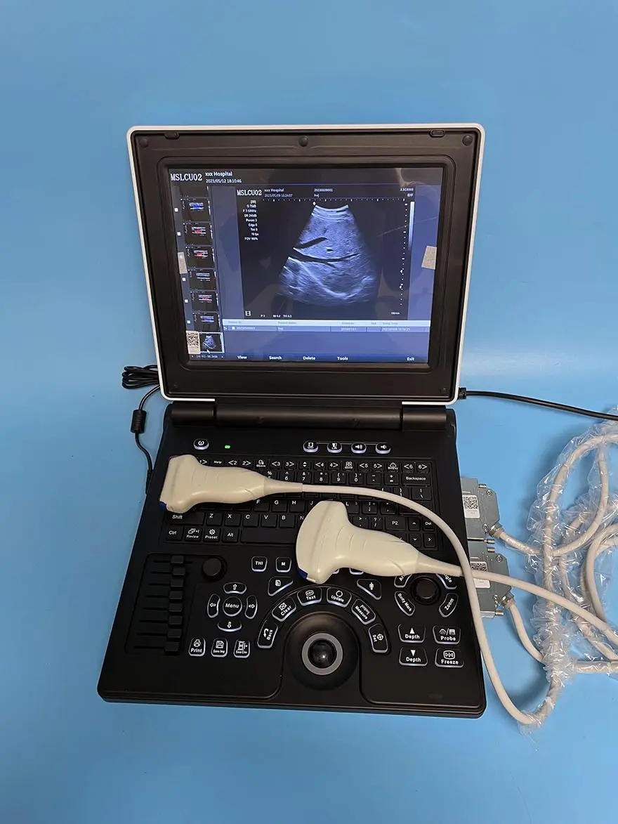 Prêt à expédier 3d 4d Machine moins cher Offre Spéciale Portable couleur doppler Machine à ultrasons vétérinaire humain