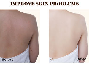 Hot vendendoci capsule di collagene sbiancanti per la pelle Private Label - Product Image 5