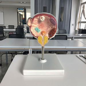 Enfermedades <span class=keywords><strong>de</strong></span> la vejiga y la próstata, modelo <span class=keywords><strong>de</strong></span> anatomía humana médica, patologías del sistema urinario masculino - Product Image 3