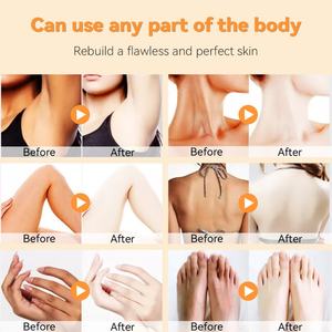 Jabón 100% Natural con Ácido Kójico para Mujeres, Equilibrio del pH, Desodorante Vaginal, Cuidado Vaginal con Espuma, Blanqueador Femenino Probiótico - Product Image 5