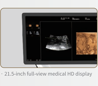 Appareil de Diagnostic de Type chariot à ultrasons de couleur Scanner à ultrasons exclusif Équipement médical portable à ultrasons 3D/4D/5D