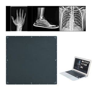 Máquina de Raio-X <span class=keywords><strong>Digital</strong></span> Equipamentos Médicos Raio-X 100ma Máquina de Raio-X Dr Equipamento Hospitalar Máquina de Raio-X Móvel - Product Image 2