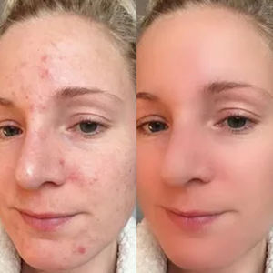 มาส์กหน้าดินเหนียวสีแดง50มล. สินค้าตรา - Product Image 3