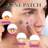 OEM SADOER personnalisé coréen patch de guérison des boutons d'acné maquillage végétalien autocollant de dissolvant de taches de peau d'acné patchs d'acné pour les soins de la peau du visage
