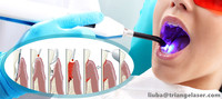 Laser diode dentaire Triangelaser 980 nm pour thérapie laser de faible intensité / photo-biomodulation / blanchiment des dents, appareil laser dentaire
