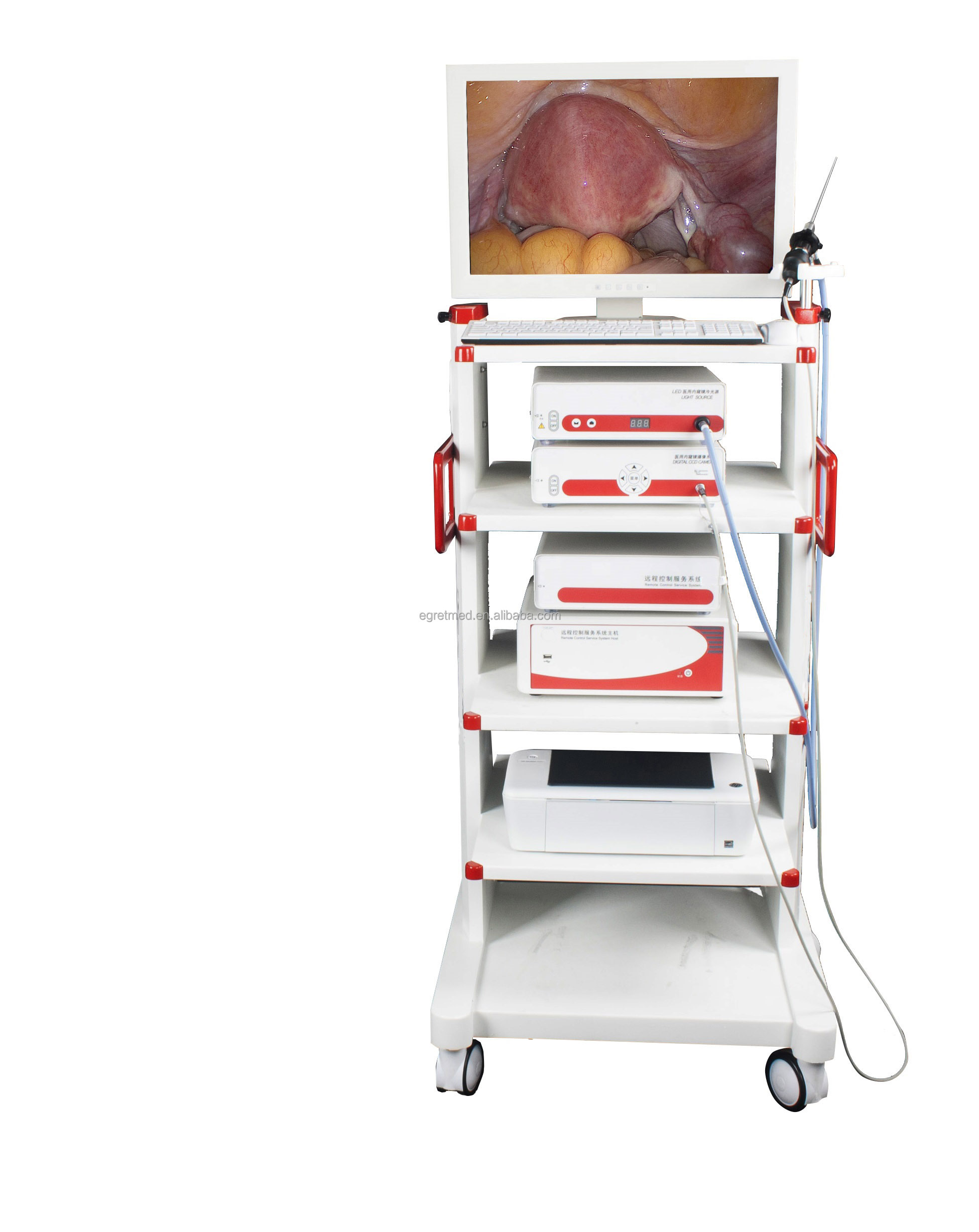 Conjunto completo de artroscopia y endoscopia médica